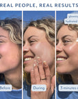 Aisha Before, during and after using Bloomeffects Sunscreen Serum