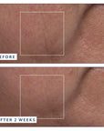 Before and after comparison of skin texture with a close-up showing improvement over 2 weeks.