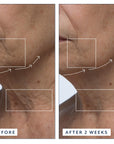 Before and after of using Vitamin C