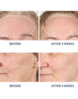 Before and after comparison showing visibly reduced wrinkles on forehead and cheeks after 4 weeks of using Black Tulip Regenerative Brightening Serum.