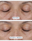 Before and after 4 weeks: front-on close-up of a woman's closed eyes, with the under-eye area of both eyes outlined in white, after using Black Tulip Regenelift Eye.
