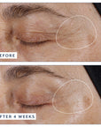 Before and after 4 weeks: angled close-up of a woman's closed left eye, with the outer corner and crow's feet area outlined in white, after using Black Tulip Regenelift Eye.