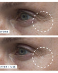 Before and after comparison of skin texture on a person's face