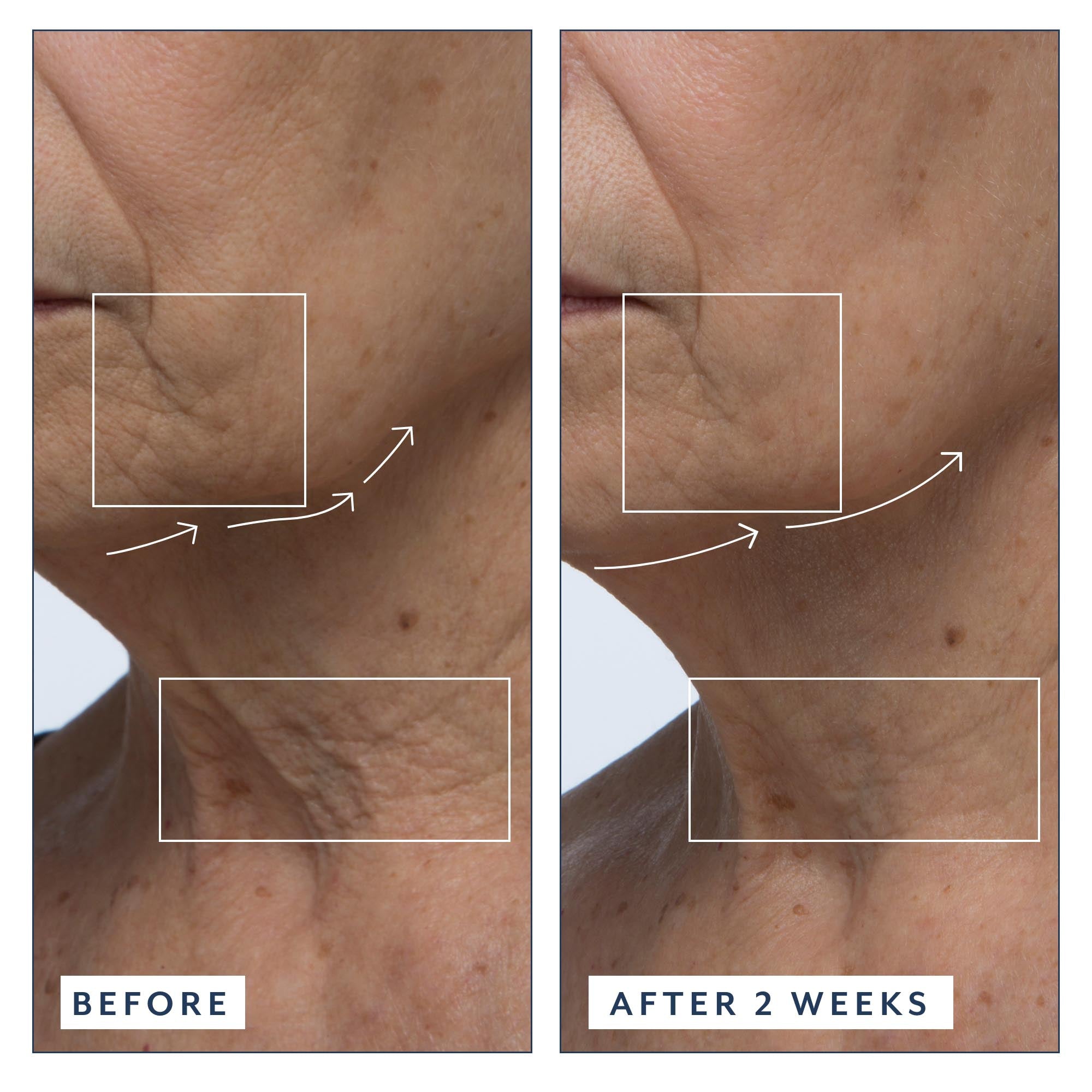 Before and after of using Vitamin C